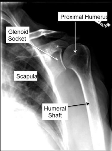 Boston Shoulder Institute – Normal anatomy