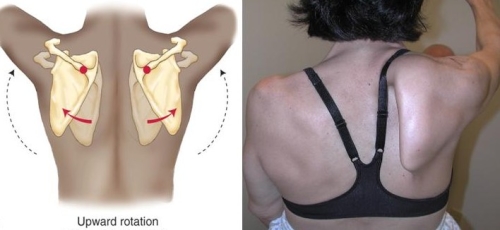 anatomy of scapular winging