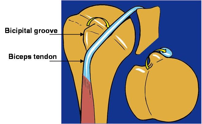 Biceps And Slap Lesions Boston Shoulder Institute 4165