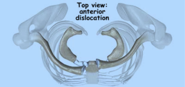 sternoclavicular-joint19