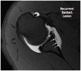 Boston Shoulder Institute – 12